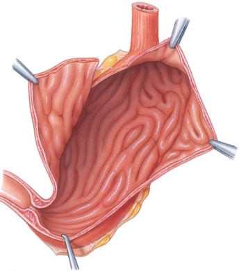 The large folds of the stomach mucosa (shown here)  are called ________.   A)  villi B)  rugae C)  papillae D)  mesentery