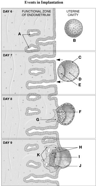   Using the figure above, identify the labeled part. -Label H: ________