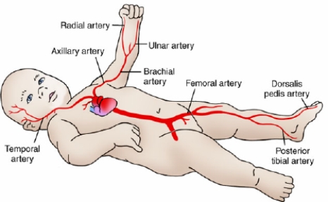 Which of the following arteries is considered the optimal puncture site for obtaining arterial blood samples from a pediatric patients?   A)  Radial artery B)  Axillary artery C)  Ulnar artery D)  Popliteal artery 