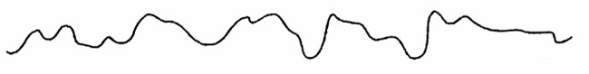 On the basis of the following waveform, in which of the following anatomic locations is the distal tip of the pulmonary artery catheter located?   A)  Right atrium B)  Right ventricle C)  Pulmonary artery D)  Wedged position 