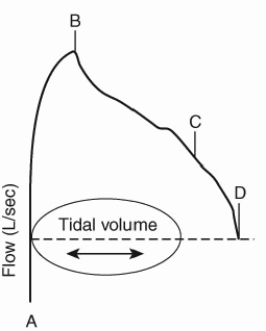 On the partial expiratory flow-volume loop shown here, identify the point depicting the maximal expiratory flow at FRC.   A)  A B)  B C)  C D)  D 