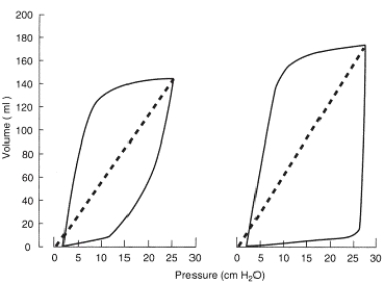 The following pressure-volume loop was obtained from a patient receiving mechanical ventilation in the pressure support mode. What type of problem does this ventilator graphic represent?   A)  Insufficient flow caused by insufficient driving pressure B)  Pressure sensitivity set inappropriately low C)  Excessive tidal volume D)  Increased mechanical dead space 