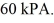 Molar heat capacities: The temperature of an ideal gas in a sealed 0.40-   rigid container is reduced from 350 K to   The final pressure of the gas is   The molar heat capacity at constant volume of the gas is 28.0 J/mol · K. The heat absorbed by the gas is closest to A)  -24 kJ. B)  -31 kJ. C)  24 kJ. D)  31 kJ. E)  0.00 kJ.