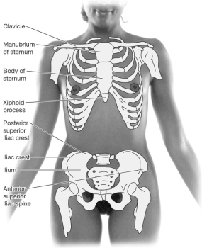 Place an  X  over the preferred site of a bone marrow biopsy.  