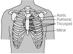 On the diagram below, place an X over the point of maximal impulse (PMI) where the stethoscope is placed to assess the apical pulse.  