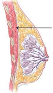 In this image of the female breast, the line points to the   A)  adipose tissue B)  lobule containing alveoli C)  pectoralis major muscle D)  milk duct E)  areola