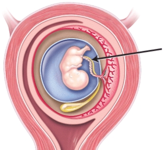 Identify the structure indicated by the arrow in the image below.   A)  amnion B)  umbilical cord C)  yolk sac D)  chorion E)  allantois