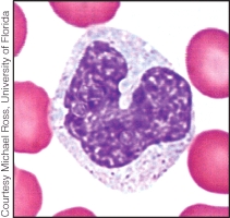 Identify the type of leukocyte shown in the image.   A)  lymphocyte B)  eosinophil C)  basophil D)  neutrophil E)  monocyte