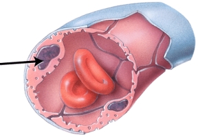 Identify the part indicated in the image.   A)  vesicle B)  basement membrane C)  nucleus of endothelial cell D)  lumen E)  intercellular cleft