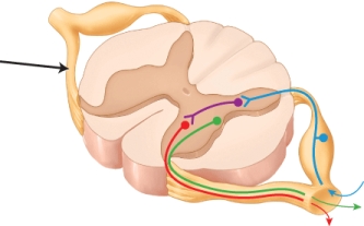 Your sweat glands are monitored and activated by your nervous system (that's why your palms might sweat when you're nervous) . How would damage to the region of the spinal column identified by the arrow, affect the function of the sweat glands?   A)  increased activity, more sweating B)  decreased activity, less sweating C)  no effect, this region only innervates muscles D)  no effect, this region only innervates effectors