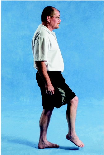   -Weakness in which of the following muscles is MOST LIKELY to contribute to the atypical gait pattern shown in the image? A) Tibialis posterior B) Gluteus maximus C) Tibialis anterior D) Rectus femoris
