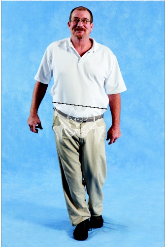   -Weakness in which of the following muscles is MOST LIKELY to produce the atypical gait shown in the image? A) Right hip abductors B) Left hip abductors C) Right hip adductors D) Left hip adductors