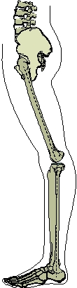  -Which of the following knee postures is depicted in the image? A) Valgus B) Recurvatum C) Varus D) Torsion