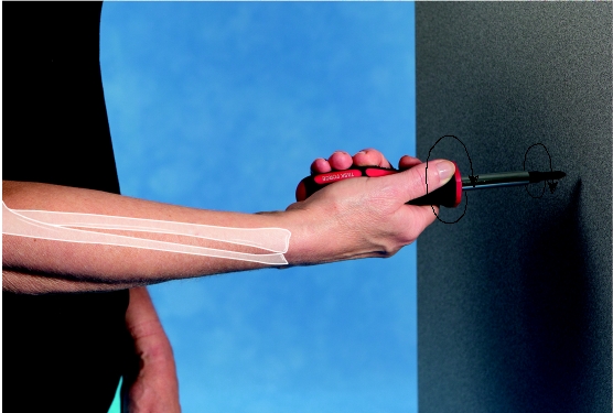   -What is the function of the triceps as shown in the image as the screwdriver is used to tighten a screw? A) Supinates the forearm B) Counters the flexion component of the biceps C) Pronates the forearm D) Counters the supination component of the biceps