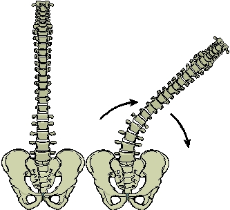   -What motion is MOST OFTEN coupled with lateral flexion of the spine in the image? A) Rotation B) Flexion C) Side-bending D) Extension