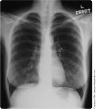 Figure 24.1   Anterior chest X-ray of a normal, middle-aged, female subject. -Discuss briefly the dependence of the colour of various media in Fig. 24.1 on photoelectric absorption.
