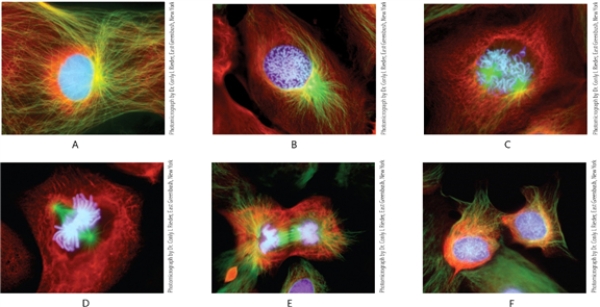 Figure 7-1   Photomicrograph by Dr. Conly L. Rieder, East Greenbush, New York -Which stage of mitosis is shown in photo E in the figure? A)  interphase B)  metaphase C)  prophase D)  anaphase 