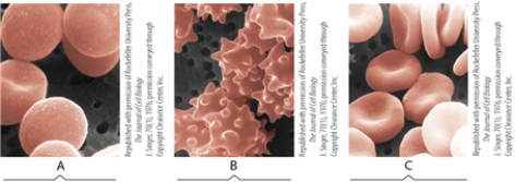 These micrographs of animal cells depict the effects of various aqueous environments on red blood cells placed in a hypotonic, hypertonic, or isotonic environment. Match each term to a micrograph.   ©1976 The Rockefeller University Press. The Journal of Cell Biology, 1976, 70:193-203. doi: 10.1083/jcb.70.1.1 -hypertonic