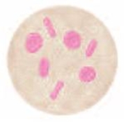 The type of cells pictured here are ________ cells.