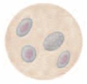 The epithelial cells found in urine and pictured here are ________ cells.