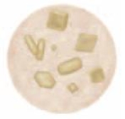The crystals found in urine and pictured here are ________ crystals.