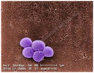 The bacteria shown in the figure are ____.   A)  vibrios B)  cocci C)  spirilla D)  bacilli E)  parasites