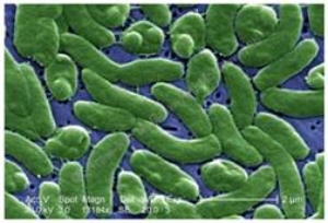 The comma-shaped bacteria pictured here are ____.   A)  bacilli B)  vibrios C)  cocci D)  spirilla E)  parasites