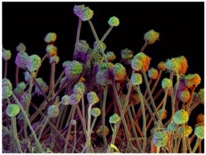 The microorganisms pictured here are ____.   A)  protozoans B)  bacteria C)  fungi D)  viruses E)  helminths