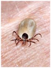 Trinity is a 9-year-old patient who has a fever, swollen glands, and a red rash. Upon examination, the physician found the organism shown in the picture. Which of the following diseases might the physician suspect based on this evidence?   A)  Malaria B)  Legionnaire's disease C)  SARS D)  Tetanus E)  Lyme disease