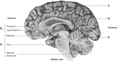   -This is a midsagittal section of the right half of the brain. What does  C  represent? A)  cerebrum B)  cerebellum C)  corpus callosum D)  diencephalon E)  brainstem 