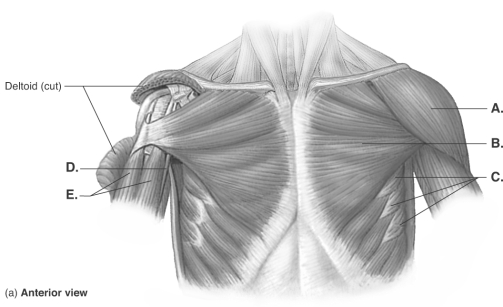   -What does  A  represent? A)  coracobrachialis B)  deltoid C)  pectoralis major D)  biceps brachii E)  serratus anterior 