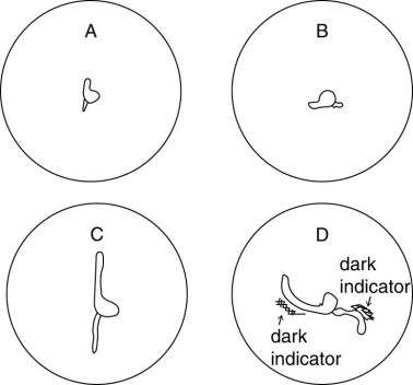 Corn seeds were germinated on two petri dishes of agar containing a colored pH indicator. The dishes were placed on edge with the seedling oriented either vertically (A)  or horizontally (B) . After 24-hours growth, the plates appeared as in C and D. Dark areas in D indicate lower pH.   Which of the following statements is supported using the data? A)  During gravitropism, the concentration of auxin is higher on the topside of a coleoptile and the bottom side of a root. B)  During gravitropism, the pH is higher on the topside of the coleoptile and the bottom side of the root. C)  The higher the concentration of auxin in a tissue, the lower will be the pH around that tissue. D)  Phototropism affects only stems causing them to bend up; gravitropism affects only roots causing them to bend down 