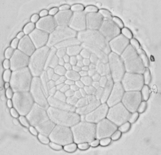The image below is a cross section through a young root tip with a layer of root cap cells surrounding the developing epidermis and interior tissues. The darker epidermal cells are stained to express the homeotic gene GLABRA-2. Which of the following best predicts what will be the appearance of this part of the mature root?   A)  The epidermis will lack root hairs. B)  Only the stained epidermal cells will develop root hairs. C)  Only the unstained cells will develop root hairs. D)  Every epidermal cell will develop a root hair. 