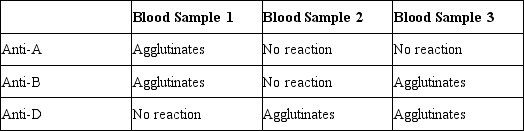 Three blood samples are exposed to the antiserums shown below with the given reactions. Based on these results, determine the ABO/Rh blood type of each sample.   