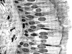 Figure 39-1 Use the figure to answer the corresponding question(s) .   -The difference between elastic and reticular fibers is that only elastic fibers: A)  are branched. B)  stretch. C)  are made of collagen. D)  form the supporting framework for organs. E)  have a high tensile strength.