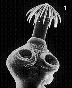 Figure 31-3 Use the figure to answer the corresponding question(s) .   -The structure shown in Figure 31-3 is from an animal in phylum: A) CestodA. B) TurbellariA. C) TrematodA. D) MonogeneA. E) Platyhelminthes.