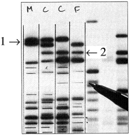 Figure 15-3 Use the figure to answer the corresponding question(s) .   -The columns in Figure 15-3 represent F (for female) , C (for children) , and M (for male) .The presence of the band marked with arrow #2, shows that: A)  this DNA sequence in the children is a mutation. B)  this DNA sequence in the children is inherited from their mother. C)  this DNA sequence in the children is inherited from their father. D)  this sequence in the children is inherited from both their mother and father. E)  individual F is not the mother of these children.