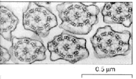 The structures in the micrograph are:   A)  chloroplasts. B)  cilia. C)  rough ER. D)  flagella. E)  B and D.