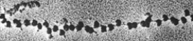   -The structure in the above figure demonstrates which of the following? A)  transcription and translation occur simultaneously on a single strand B)  ribosomes attached to a strand of DNA C)  a small ribosomal subunit D)  multiple ribosomes on a strand of mRNA E)  all of these
