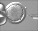   -The above figure represents A)  cloning with a stem cell. B)  somatic cell nuclear transfer. C)  genetic manipulation of a single gene. D)  microsurgical manipulation of a chromosome. E)  none of these.