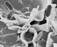   -The tube-like structures extending from these bacterial cells in the picture above to the underlying cells in the above figure are used for A)  attachment. B)  locomotion. C)  whipping up proteins. D)  breathing. E)  communication.