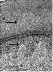   -The letter  A  in the above figure represents A)  keratin-filled, dead epithelial cells. B)  replicating epithelium. C)  mucus produced by underlying ciliated cells. D)  white blood cells attacking a bacterial cell. E)  all of these.