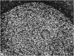   -Which system involves plasma proteins activated when an organism's pattern receptors become bound to anything? A)  cytokine B)  complement C)  suppressor D)  enhancer E)  coagulation