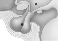   -Pituitary dwarfism may be due to insufficient production of A)  mineralocorticoid. B)  glucocorticoid. C)  calcitonin. D)  GH. E)  the parathyroid hormone.