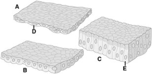   The following questions refer to the figure above of epithelial tissues. -Which of the following is NOT a connective tissue? A)  bone B)  muscle C)  cartilage D)  adipose E)  blood