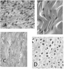  -People with a large amount of which tissue are least likely to be sensitive to cold? A)  cartilage B)  adipose C)  blood D)  dense connective E)  bone