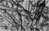   -The above photomicrograph is of A)  mycelium. B)  protistans. C)  mycorrhizae. D)  stolons. E)  rhizoids.