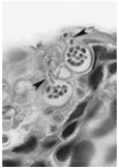   -The above figure represents ____, a group of parasitic fungi that are killing amphibians around the world. A)  Chytrids B)  Ascomycetes C)  Basidiomycetes D)  Glomeromycetes E)  Zygomycetes