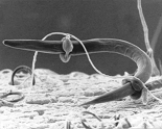   -The above figure is of ____ A)  Arthrobotrys. B)  a parasitic fungus. C)  a fungus attacking a nematode. D)  a sac fungus. E)  all of these.