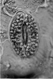   -Which of the following statements concerning fertilization in ferns is true? A)  It occurs outside the egg-producing structure. B)  It requires water. C)  The fertilization product is haploid. D)  A spore is the product of fertilization. E)  None of these are true.